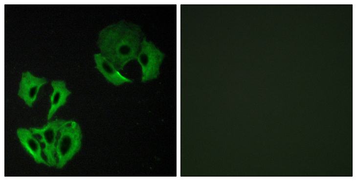 DENN / MADD Antibody - Immunofluorescence analysis of A549 cells, using MADD Antibody. The picture on the right is blocked with the synthesized peptide.
