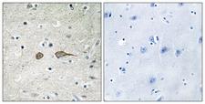 DENN / MADD Antibody - Immunohistochemistry analysis of paraffin-embedded human brain tissue, using MADD Antibody. The picture on the right is blocked with the synthesized peptide.