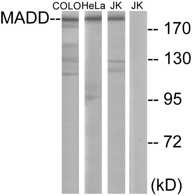 DENN / MADD Antibody - Western blot analysis of lysates from COLO, HeLa, and Jurkat cells, using MADD Antibody. The lane on the right is blocked with the synthesized peptide.