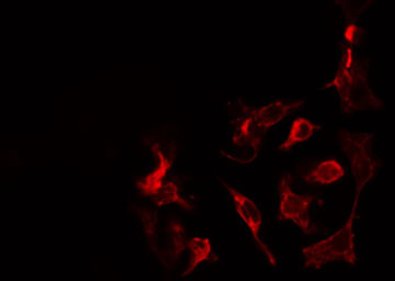 DENN / MADD Antibody - Staining COLO205 cells by IF/ICC. The samples were fixed with PFA and permeabilized in 0.1% Triton X-100, then blocked in 10% serum for 45 min at 25°C. The primary antibody was diluted at 1:200 and incubated with the sample for 1 hour at 37°C. An Alexa Fluor 594 conjugated goat anti-rabbit IgG (H+L) antibody, diluted at 1/600, was used as secondary antibody.