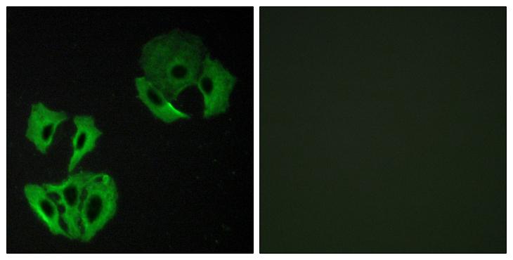 DENN / MADD Antibody - Peptide - + Immunofluorescence analysis of A549 cells, using MADD antibody.
