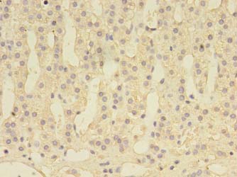 DENND1A Antibody - Immunohistochemistry of paraffin-embedded human adrenal gland tissue using antibody at 1:100 dilution.