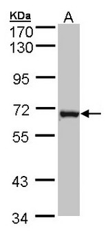 DENND1B Antibody - Sample (30 ug of whole cell lysate). A: MOLT4 . 7.5% SDS PAGE. DENND1B antibody diluted at 1:1000