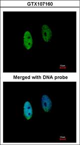 DENND1B Antibody - Immunofluorescence of paraformaldehyde-fixed HeLa using DENND1B antibody at 1:200 dilution.