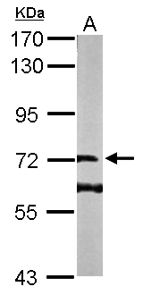 DENND1B Antibody - Sample (50 ug of whole cell lysate). A: Mouse brain. 7.5% SDS PAGE. DENND1B antibody diluted at 1:1000.