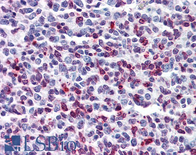 DENND1B Antibody - Anti-DENND1B antibody IHC of human tonsil. Immunohistochemistry of formalin-fixed, paraffin-embedded tissue after heat-induced antigen retrieval. Antibody concentration 5 ug/ml.  This image was taken for the unconjugated form of this product. Other forms have not been tested.