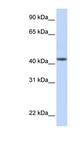 DENND1B Antibody - DENND1B antibody Western blot of Fetal Muscle lysate. This image was taken for the unconjugated form of this product. Other forms have not been tested.