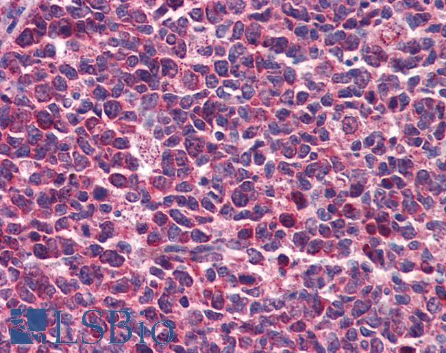 DENND1B Antibody - Anti-DENND1B antibody IHC of human tonsil. Immunohistochemistry of formalin-fixed, paraffin-embedded tissue after heat-induced antigen retrieval. Antibody concentration 5 ug/ml.  This image was taken for the unconjugated form of this product. Other forms have not been tested.