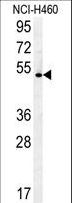 DENND1B Antibody - DENND1B Antibody western blot of NCI-H460 cell line lysates (35 ug/lane). The DENND1B antibody detected the DENND1B protein (arrow).