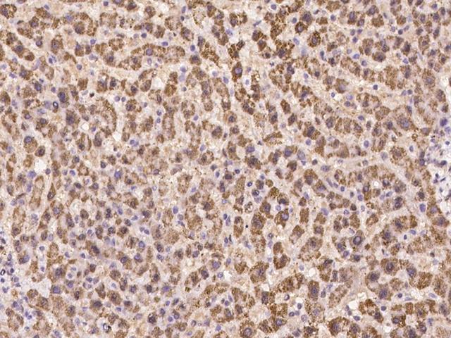 DENND1B Antibody - Immunochemical staining of human DENND1B in human liver with rabbit polyclonal antibody at 1:300 dilution, formalin-fixed paraffin embedded sections.