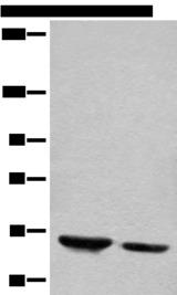 DENND1B Antibody - Western blot analysis of Human fetal brain tissue and mouse brain tissue lysates  using DENND1B Polyclonal Antibody at dilution of 1:400