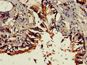 DENND1C Antibody - Immunohistochemistry of paraffin-embedded human lung tissue at dilution of 1:100