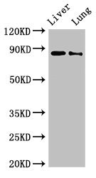 DENND1C Antibody - Western Blot Positive WB detected in:Rat liver tissue,Rat lung tissue All Lanes:DENND1C antibody at 3µg/ml Secondary Goat polyclonal to rabbit IgG at 1/50000 dilution Predicted band size: 88,83 KDa Observed band size: 88 KDa
