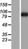 DENND1C Protein - Western validation with an anti-DDK antibody * L: Control HEK293 lysate R: Over-expression lysate
