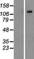 DENND2A / KIAA1277 Protein - Western validation with an anti-DDK antibody * L: Control HEK293 lysate R: Over-expression lysate