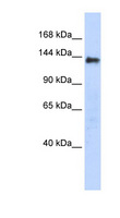 DENND2C Antibody - DENND2C antibody Western blot of Transfected 293T cell lysate. This image was taken for the unconjugated form of this product. Other forms have not been tested.