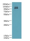 DENND2C Antibody - Western blot. All lanes: DENND2C antibody at 8 ug/ml+A40- whole cell lysate Goat polyclonal to rabbit at 1:10000 dilution. Predicted band size: 107 kDa. Observed band size: 107 kDa.