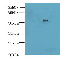 DENND2D Antibody - Western blot. All lanes: DENND2D antibody at 4 ug/ml+ MCF7 whole cell lysate Goat polyclonal to rabbit at 1:10000 dilution. Predicted band size: 54 kDa. Observed band size: 54 kDa.