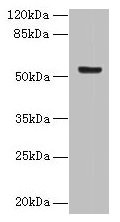 DENND2D Antibody - Western blot All lanes: DENND2D antibody at 4µg/ml + MCF-7 whole cell lysate Secondary Goat polyclonal to rabbit IgG at 1/10000 dilution Predicted band size: 54 kDa Observed band size: 54 kDa