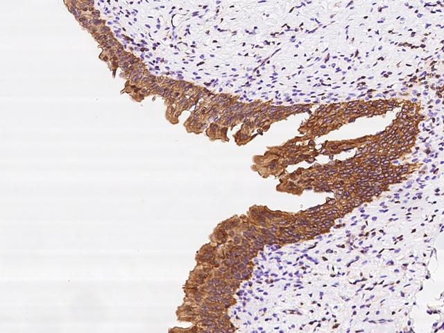 DENND2D Antibody - Immunochemical staining of human DENND2D in human urinary bladder with rabbit polyclonal antibody at 1:200 dilution, formalin-fixed paraffin embedded sections.