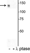 DENND3 Antibody - Western blot of HeLa cell lysate showing specific immunolabeling of the ~142 kDa DENND3 protein phosphorylated at Thr450 in the first lane (-). Phosphospecificity is shown in the second lane (+) where immunolabeling is completely eliminated by lysate treatment with lambda phosphatase (?-Ptase, 800 units/1mg protein for 30 min).