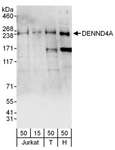 DENND4A Antibody - Detection of Human DENND4A by Western Blot. Samples: Whole cell lysate from Jurkat (15 and 50 ug), 293T (T; 50 ug) and HeLa (H; 50 ug) cells. Antibodies: Affinity purified rabbit anti-DENND4A antibody used for WB at 0.4 ug/ml. Detection: Chemiluminescence with an exposure time of 30 seconds.