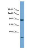 DENND5A Antibody - DENND5A antibody Western Blot of 721_B. Antibody dilution: 1 ug/ml.  This image was taken for the unconjugated form of this product. Other forms have not been tested.
