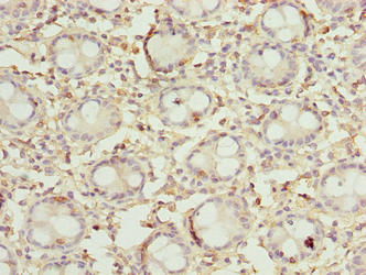 DENND5A Antibody - Immunohistochemistry of paraffin-embedded human rectum tissue using DENND5A Antibody at dilution of 1:100