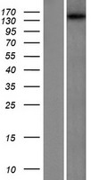 DENND5A Protein - Western validation with an anti-DDK antibody * L: Control HEK293 lysate R: Over-expression lysate