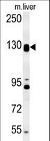 DENND5B Antibody - DENND5B Antibody western blot of mouse liver tissue lysates (15 ug/lane). The DENND5B antibody detected DENND5B protein (arrow).