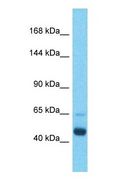 DENND5B Antibody - Western blot of DENND5B Antibody with human Lung Tumor lysate.  This image was taken for the unconjugated form of this product. Other forms have not been tested.