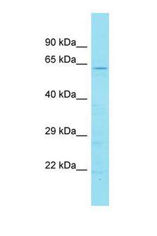 DENND6B Antibody - Western blot of Human 721_B. DENND6B antibody dilution 1.0 ug/ml.  This image was taken for the unconjugated form of this product. Other forms have not been tested.