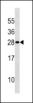 DENR / Density Regulated Antibody - DENR Antibody western blot of 293 cell line lysates (35 ug/lane). The DENR antibody detected the DENR protein (arrow).