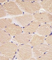 DENR / Density Regulated Antibody - Antibody staining DENR in human skeletal muscle sections by Immunohistochemistry (IHC-P - paraformaldehyde-fixed, paraffin-embedded sections). Tissue was fixed with formaldehyde and blocked with 3% BSA for 0. 5 hour at room temperature; antigen retrieval was by heat mediation with a citrate buffer (pH 6). Samples were incubated with primary antibody (1:25) for 1 hours at 37°C. A undiluted biotinylated goat polyvalent antibody was used as the secondary antibody.