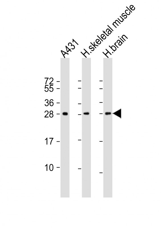 DENR / Density Regulated Antibody - All lanes: Anti-DENR Antibody at 1:1000-1:2000 dilution. Lane 1: A431 whole cell lysate. Lane 2: human skeletal muscle lysate. Lane 3: human brain lysate Lysates/proteins at 20 ug per lane. Secondary Goat Anti-mouse IgG, (H+L), Peroxidase conjugated at 1:10000 dilution. Predicted band size: 22 kDa. Blocking/Dilution buffer: 5% NFDM/TBST.