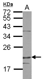 DENR / Density Regulated Antibody - Sample (50 ug of whole cell lysate) A: mouse heart 12% SDS PAGE DENR / DRP1 antibody diluted at 1:1000