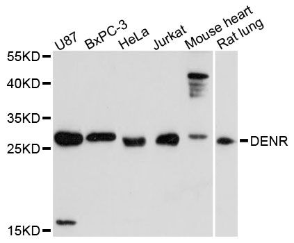 DENR / Density Regulated Antibody - Western blot analysis of extracts of various cell lines, using DENR antibody at 1:3000 dilution. The secondary antibody used was an HRP Goat Anti-Rabbit IgG (H+L) at 1:10000 dilution. Lysates were loaded 25ug per lane and 3% nonfat dry milk in TBST was used for blocking. An ECL Kit was used for detection and the exposure time was 90s.