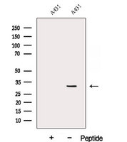 DENR / Density Regulated Antibody - Western blot analysis of extracts of A431 cells using DENR antibody. The lane on the left was treated with blocking peptide.
