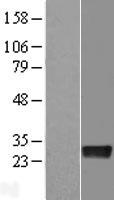 DENR / Density Regulated Protein - Western validation with an anti-DDK antibody * L: Control HEK293 lysate R: Over-expression lysate