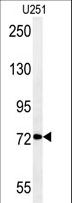 DEPDC1 Antibody - DEPDC1 Antibody western blot of U251 cell line lysates (35 ug/lane). The DEPDC1 antibody detected the DEPDC1 protein (arrow).