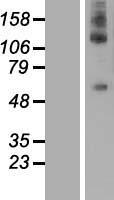 DEPDC1 Protein - Western validation with an anti-DDK antibody * L: Control HEK293 lysate R: Over-expression lysate