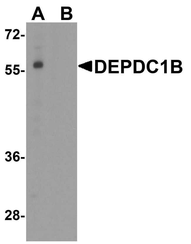 DEPDC1B Antibody - Western blot analysis of DEPDC1B in K562 cell lysate with DEPDC1B antibody at 1 ug/ml in (A) the absence and (B) the presence of blocking peptide.
