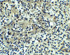 DEPDC1B Antibody - Immunohistochemistry of DEPDC1B in human spleen tissue with DEPDC1B antibody at 5 ug/ml.
