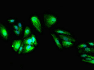 DEPDC1B Antibody - Immunofluorescent analysis of HepG2 cells at a dilution of 1:100 and Alexa Fluor 488-congugated AffiniPure Goat Anti-Rabbit IgG(H+L)
