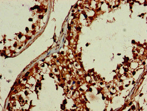 DEPDC1B Antibody - Immunohistochemistry image of paraffin-embedded human testis tissue at a dilution of 1:100