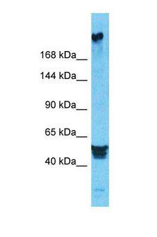 DEPDC2 Antibody - Western blot of Human HeLa. PREX2 antibody dilution 1.0 ug/ml.  This image was taken for the unconjugated form of this product. Other forms have not been tested.