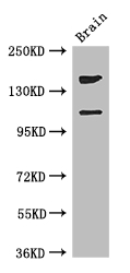 DEPDC2 Antibody - Positive WB detected in:Mouse brain tissue;All lanes: PREX2 antibody at 3.4ug/ml;Secondary;Goat polyclonal to rabbit IgG at 1/50000 dilution;Predicted band size: 183,172,113 kDa;Observed band size: 183,113 kDa;