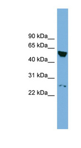 DEPDC7 Antibody - DEPDC7 antibody Western blot of NCI-H226 cell lysate. This image was taken for the unconjugated form of this product. Other forms have not been tested.