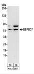 DEPDC7 Antibody - Detection of Human DEPDC7 by Western Blot. Samples: Whole cell lysate (50 ug) from HeLa and 293T cells. Antibodies: Affinity purified rabbit anti-DEPDC7 antibody used for WB at 0.4 ug/ml. Detection: Chemiluminescence with an exposure time of 3 minutes.