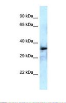 DEPTOR / DEPDC6 Antibody - Western blot of Human Fetal Brain . DEPTOR antibody dilution 1.0 ug/ml.  This image was taken for the unconjugated form of this product. Other forms have not been tested.
